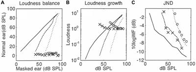 A Unified Theory of Psychophysical Laws in Auditory Intensity Perception